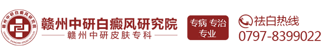 吉安白癜风医院